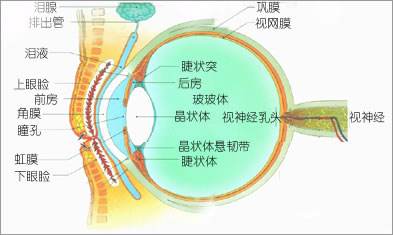 為什么會(huì)發(fā)展成高度近視？